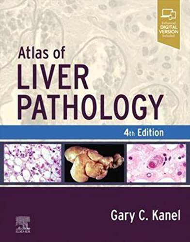 Atlas of Liver Pathology (Atlas of Surgical Pathology)