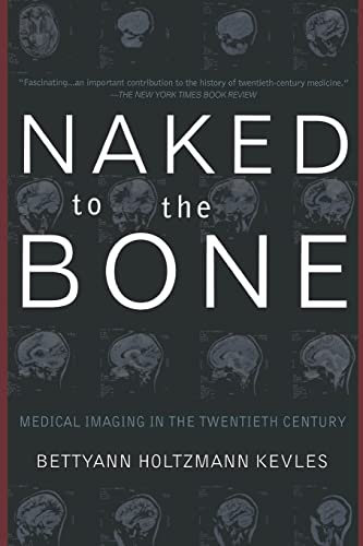 Naked to the Bone: Medical Imaging In The Twentieth Century