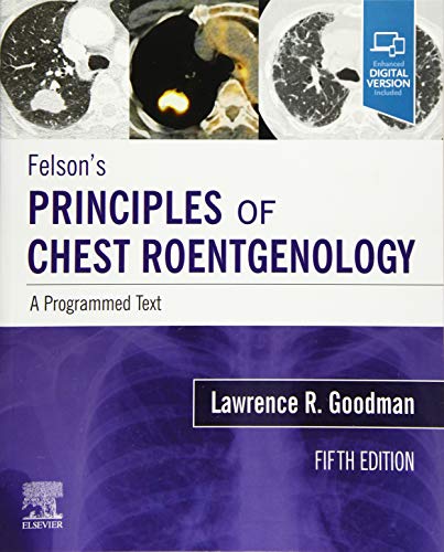 Felson's Principles of Chest Roentgenology, A Programmed Text: A Programmed Text von Elsevier