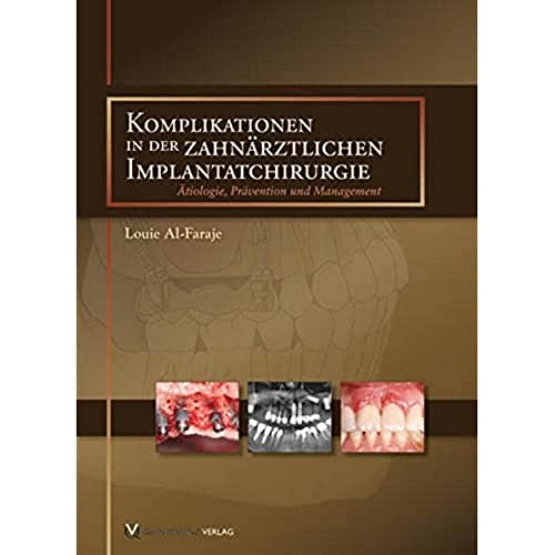 Komplikationen in der zahnärztlichen Implantatchirurgie: Ätiologie, Prävention und Management von Quintessenz Verlag