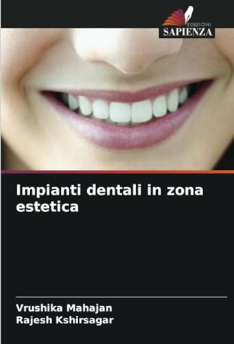 Impianti dentali in zona estetica von Edizioni Sapienza
