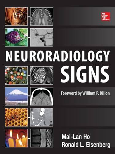 Neuroradiology Signs von McGraw-Hill Education