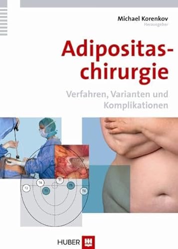 Adipositaschirurgie: Verfahren, Varianten und Komplikationen