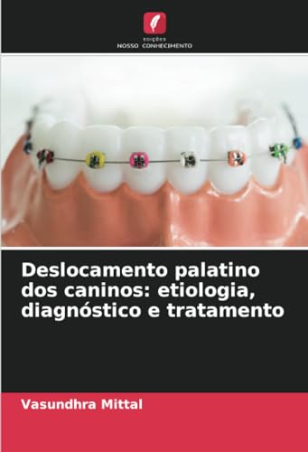 Deslocamento palatino dos caninos: etiologia, diagnóstico e tratamento von Edições Nosso Conhecimento