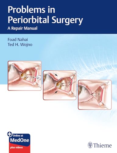 Problems in Periorbital Surgery: A Repair Manual von Thieme