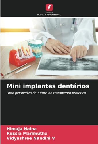Mini implantes dentários: Uma perspetiva de futuro no tratamento protético von Edições Nosso Conhecimento