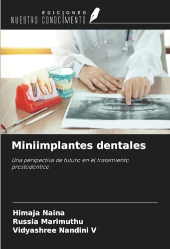 Miniimplantes dentales: Una perspectiva de futuro en el tratamiento prostodóntico von Ediciones Nuestro Conocimiento