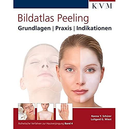 Bildatlas Peeling: Grundlagen | Praxis | Indikationen von KVM-Der Medizinverlag