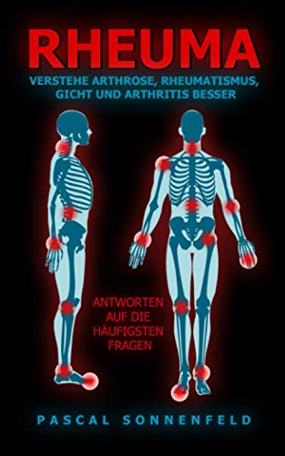 Rheuma: Verstehe Arthrose, Rheumatismus, Gicht und Arthritis besser: Antworten auf die häufigsten Fragen