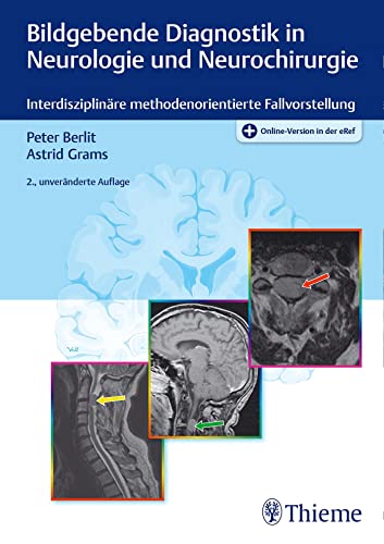 Bildgebende Diagnostik in Neurologie und Neurochirurgie: Interdisziplinäre methodenorientierte Fallvorstellung von Thieme