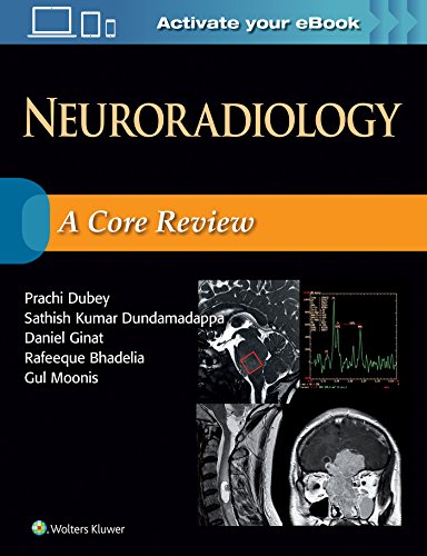Neuroradiology: A Core Review von Lippincott Williams & Wilkins