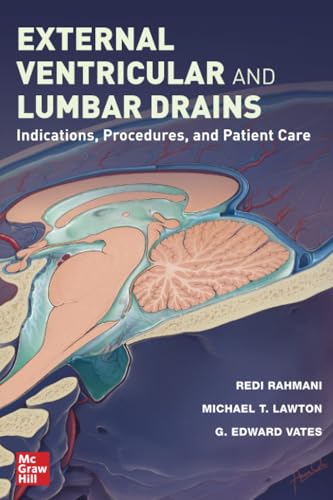 External Ventricular and Lumbar Drains: Indications, Procedures, and Patient Care von McGraw Hill / Medical