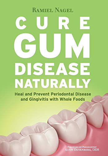 Cure Gum Disease Naturally: Heal Gingivitis and Periodontal Disease with Whole Foods von Golden Child Publishing