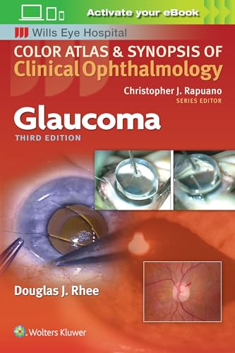 Glaucoma (Color Atlas and Synopsis of Clinical Ophthalmology) (Wills Eye Hospital Color Atlas & Synopsis of Clinical Ophthalmology)