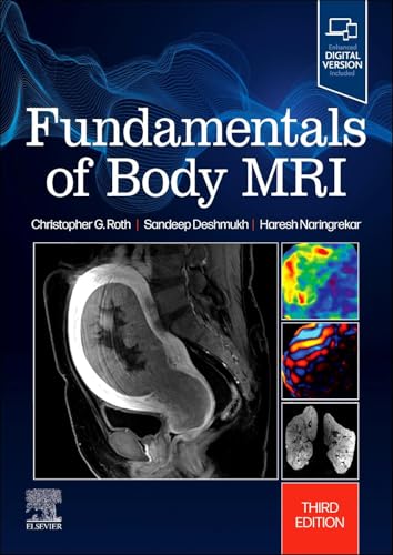 Fundamentals of Body MRI (Fundamentals of Radiology) von Elsevier