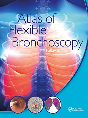 Atlas of Flexible Bronchoscopy von CRC Press