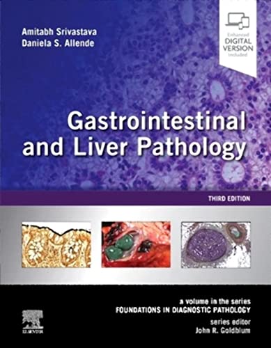 Gastrointestinal and Liver Pathology: A Volume in the Series: Foundations in Diagnostic Pathology von Elsevier