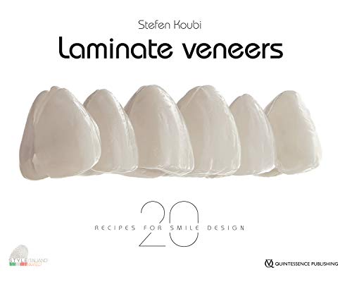 Laminate Veneers: 20 Recipes for Smile Design von Quintessence Publishing (IL)
