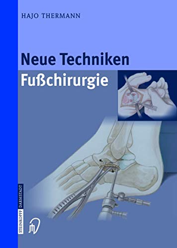 Neue Techniken Fusschirurgie (German Edition)