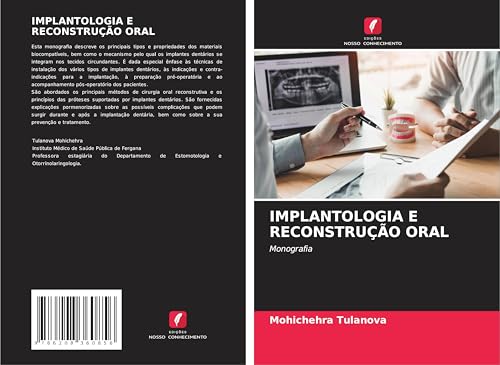 IMPLANTOLOGIA E RECONSTRUÇÃO ORAL: Monografia von Edições Nosso Conhecimento