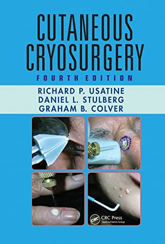 Cutaneous Cryosurgery: Principles and Clinical Practice von CRC Press