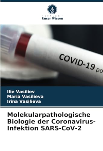 Molekularpathologische Biologie der Coronavirus-Infektion SARS-CoV-2 von Verlag Unser Wissen