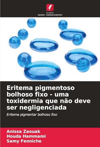 Eritema pigmentoso bolhoso fixo - uma toxidermia que não deve ser negligenciada: Eritema pigmentar bolhoso fixo von Edições Nosso Conhecimento