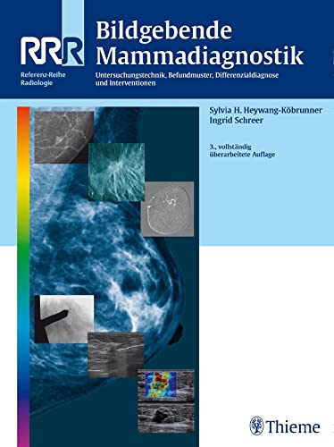 Bildgebende Mammadiagnostik: Untersuchungstechnik, Befundmuster, Differenzialdiagnose und Interventionen von Thieme