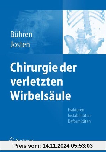 Chirurgie der verletzten Wirbelsäule: Frakturen, Instabilitäten, Deformitäten