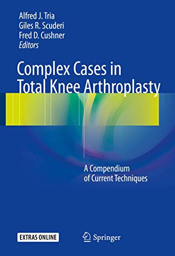 Complex Cases in Total Knee Arthroplasty: A Compendium of Current Techniques von Springer