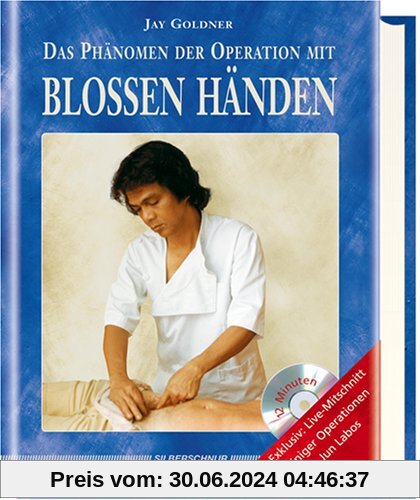 Das Phänomen der Operation mit blossen Händen, m. DVD