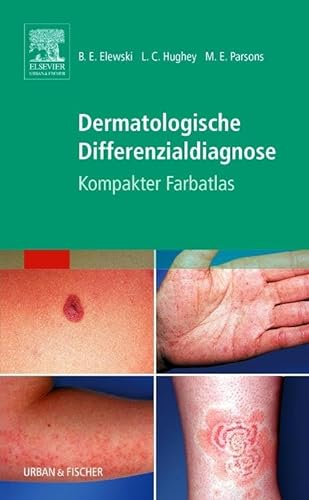 Dermatologische Differenzialdiagnose: Kompakter Farbatlas von Elsevier
