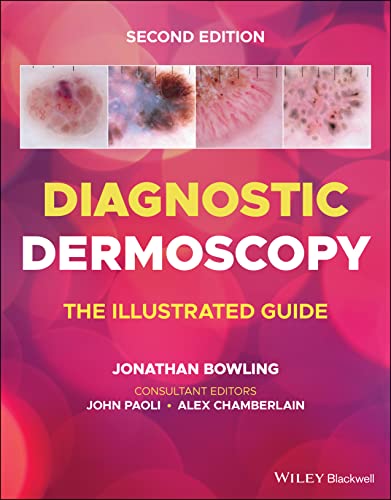 Diagnostic Dermoscopy: The Illustrated Guide von Wiley-Blackwell
