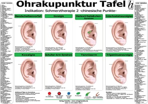 Ohrakupunktur Tafel - Indikation: Schmerztherapie 2 von Hawelka, Verlag