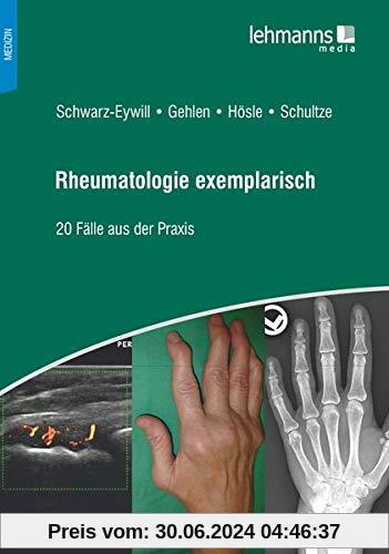 Rheumatologie exemplarisch: 20 Fälle aus der Praxis