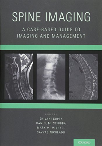 Spine Imaging: A Case-Based Guide to Imaging and Management