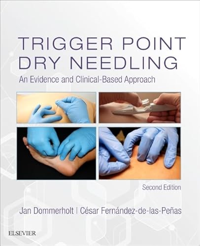 Trigger Point Dry Needling: An Evidence and Clinical-Based Approach von Elsevier