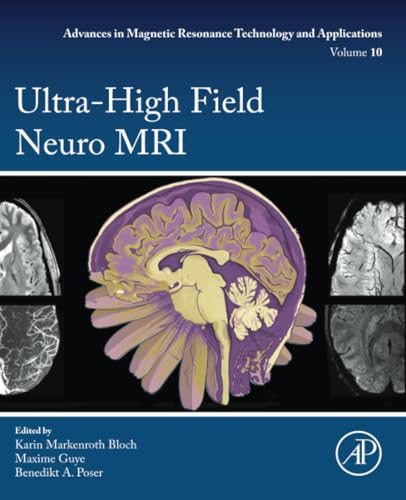 Ultra-High Field Neuro MRI: Volume 10 (Advances in Magnetic Resonance Technology and Applications, Volume 10)