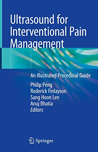 Ultrasound for Interventional Pain Management: An Illustrated Procedural Guide von Springer